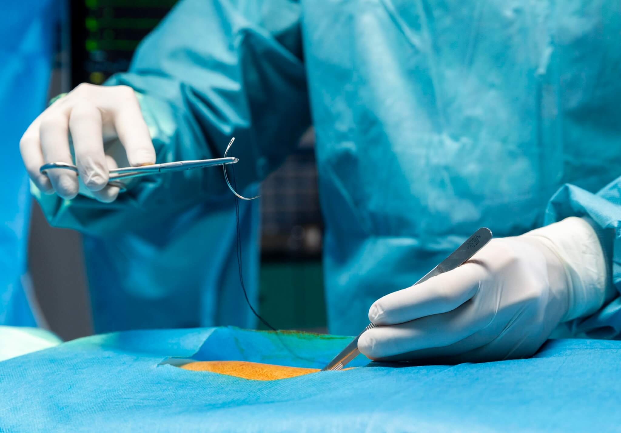Surgical sutures suppliers pipeline medical