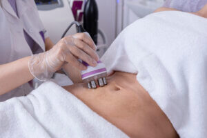 Liposuction machines for sale