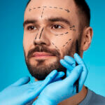 JUVEDERM® and Men: Why More Men Are Choosing Dermal Fillers