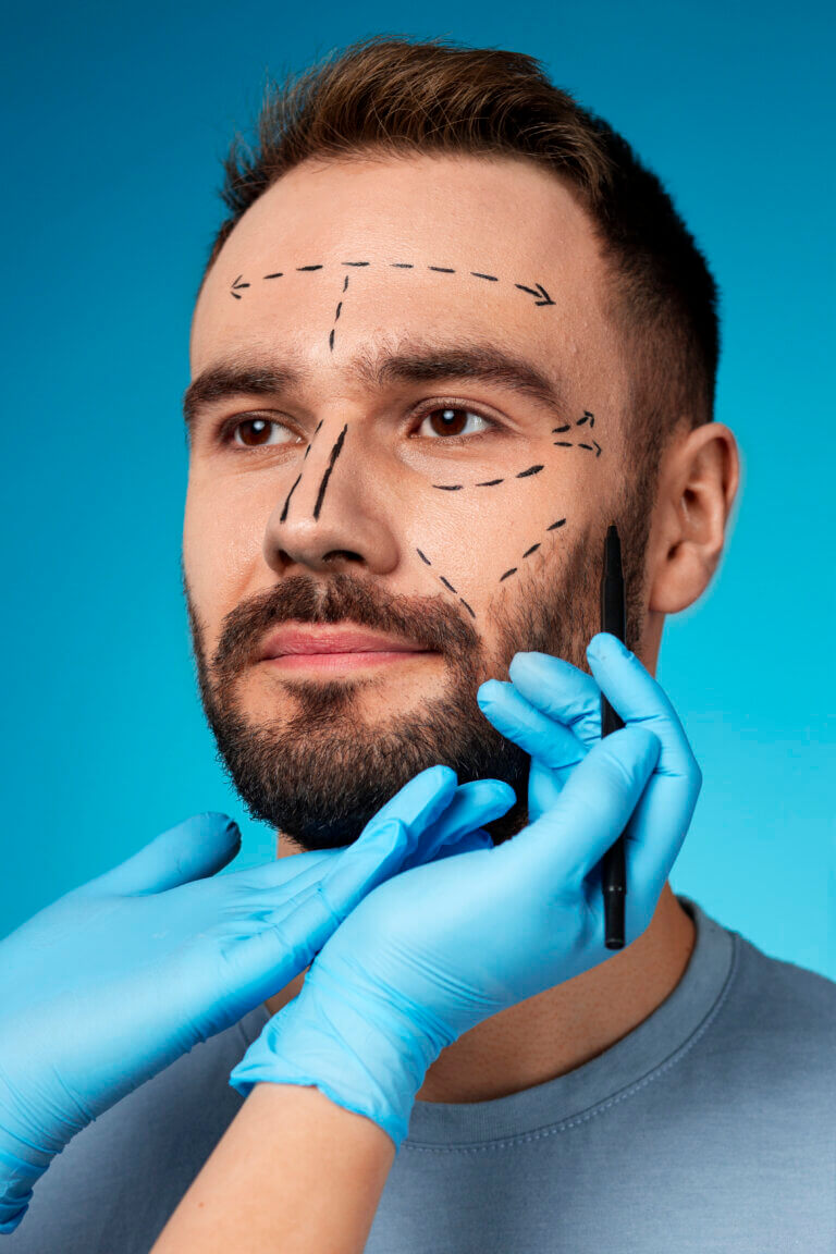 JUVEDERM® and Men: Why More Men Are Choosing Dermal Fillers