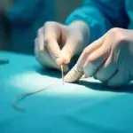 Ethicon vs Competitor Sutures comparison