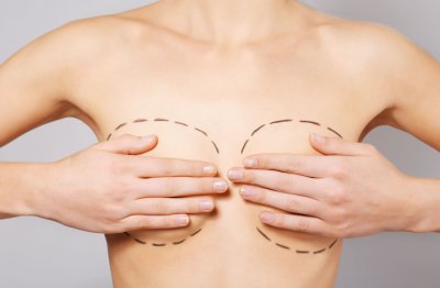 Breast augmentation supplies