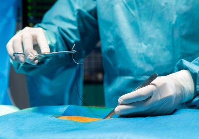 Aesthetics sutures | The Art of Wound Closure in Plastic Surgery | Pipeline medical